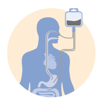 Medication Administration via Enteral Tubes گاواژ دارو، تجویز دارو از لوله تغذیه انترال