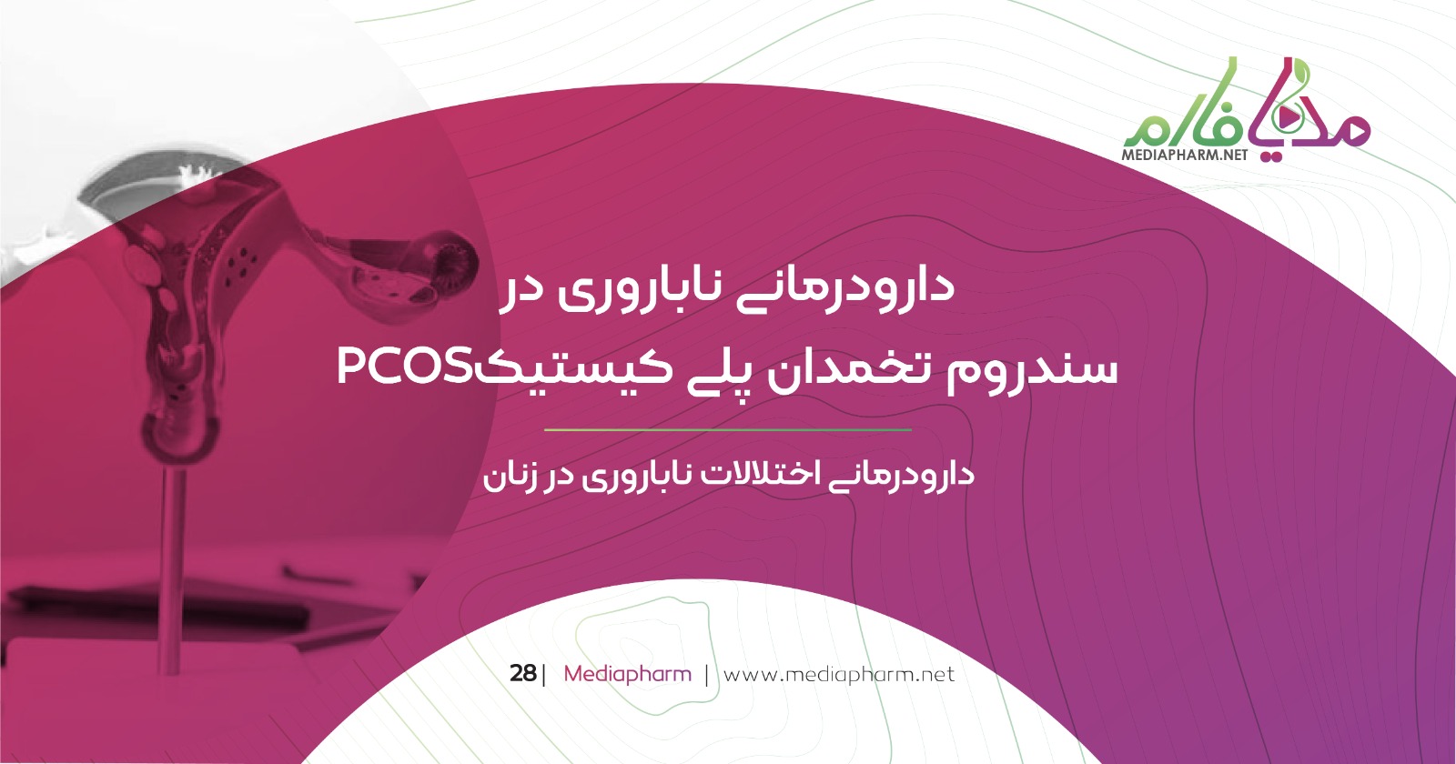 دارو درمانی ناباروری در سندروم تخمدان پلی کیستیک PCOS