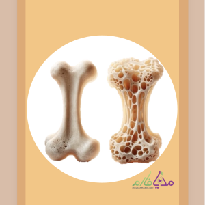 Pharmacotherapy of Osteoporosis دوره ی آموزشی پوکی استخوان (اوستئوپروز)