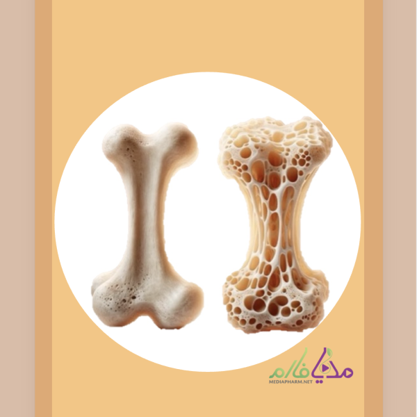 Pharmacotherapy of Osteoporosis دوره ی آموزشی پوکی استخوان (اوستئوپروز)