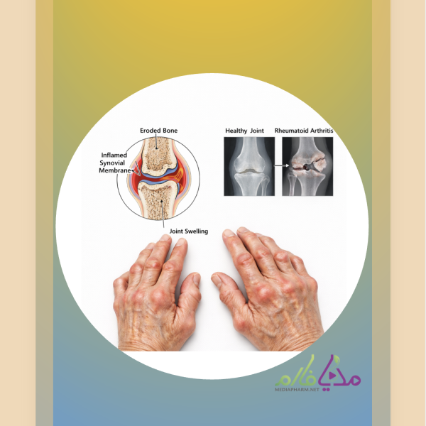 Pharmacotherapy of Rheumatoid Arthritis دوره ی آموزشی آرتریت روماتوئید
