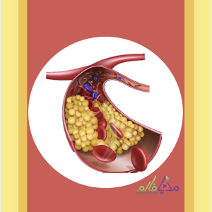 Pharmacotherapy of Dyslipidemia دوره ی آموزشی دارودرمانی دیس لیپیدمی