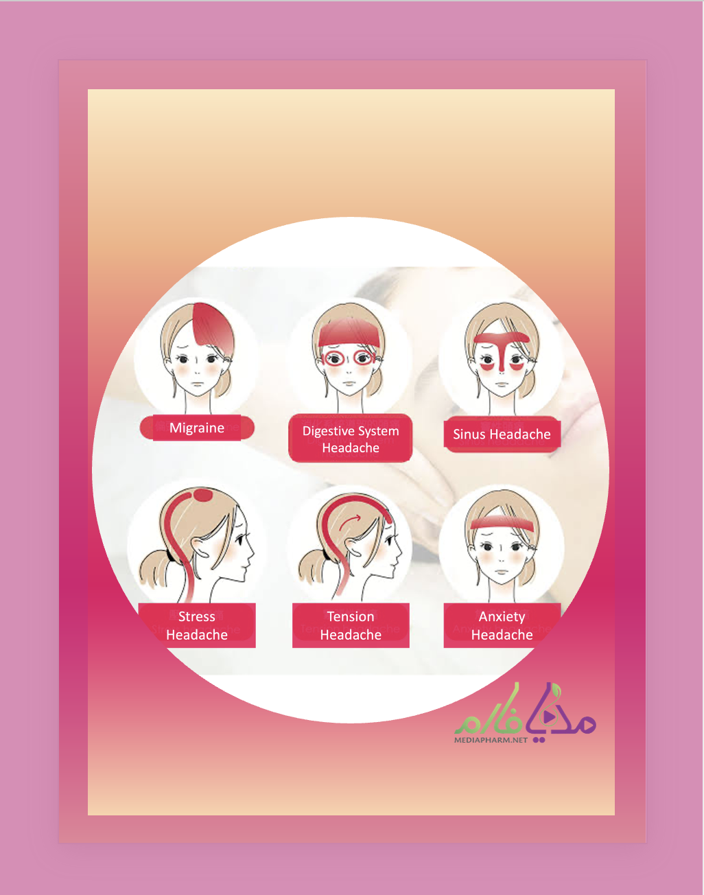 Pharmacotherapy of Headaches دارودرمانی انواع سردرد